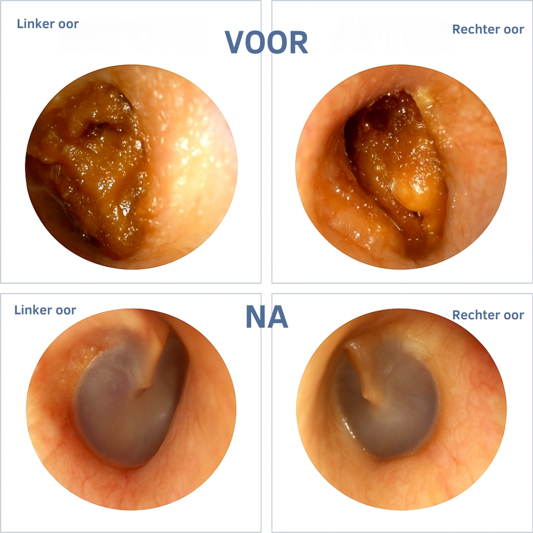 WaxClean™ – Slim oor reiniging met geavanceerde technologie